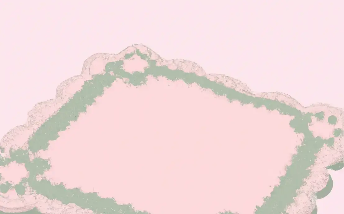 Bicos de croche em fraldas